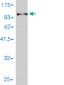 ALB Antibody (monoclonal) (M01)